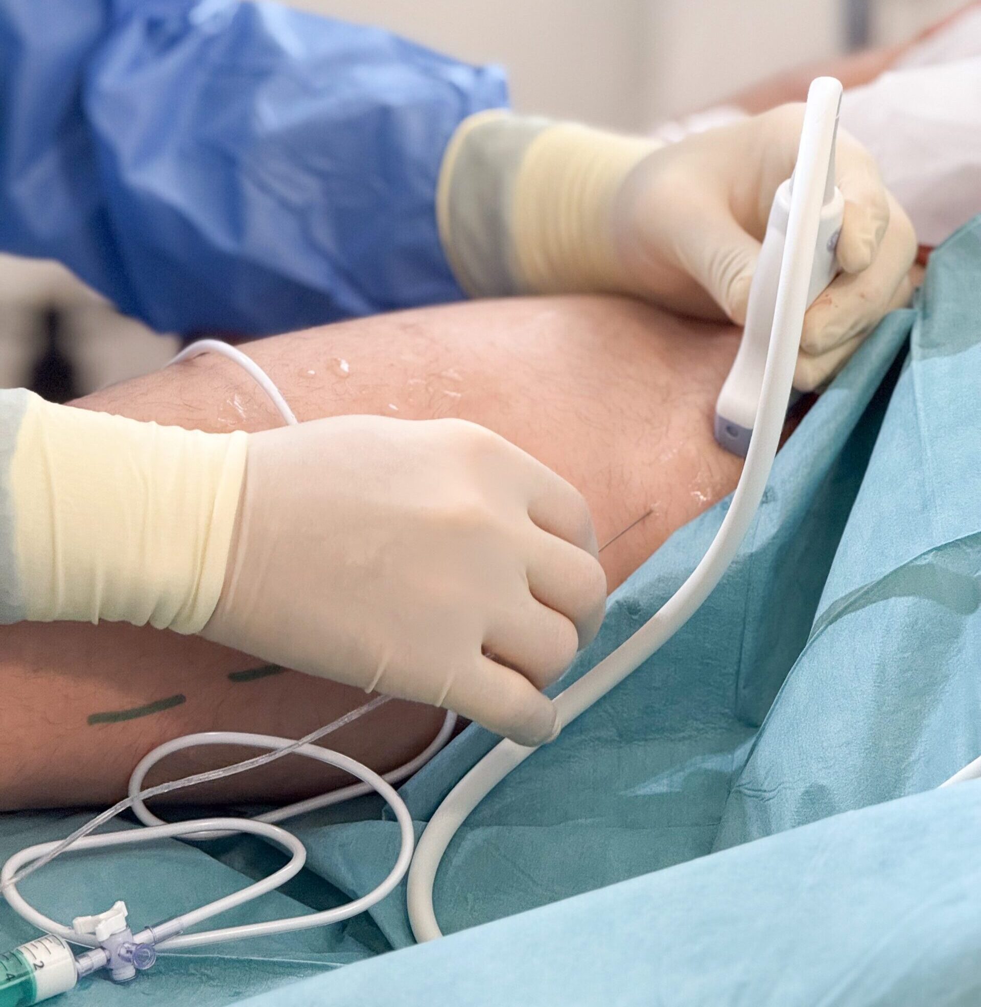 Chirurgie